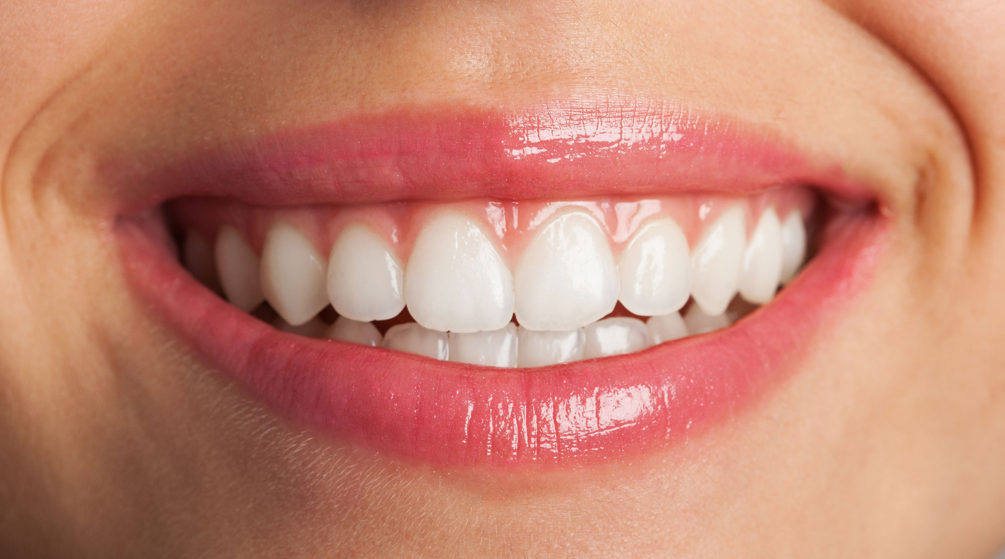 How Long Does It Take To Whiten Teeth